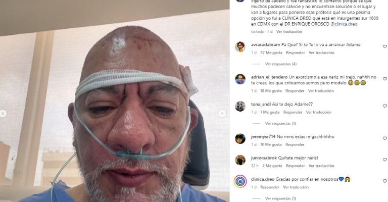 Carlos Trejo es hospitalizado y filtra foto con oxígeno