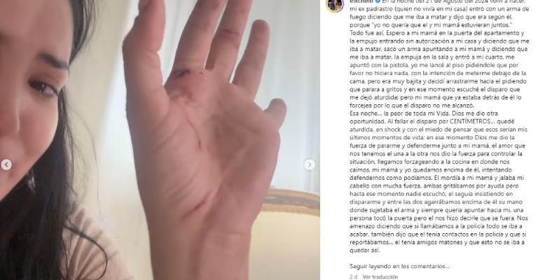 Eixchel Barroteran afirma que casi muere tras ataque a balazos de su padrastro