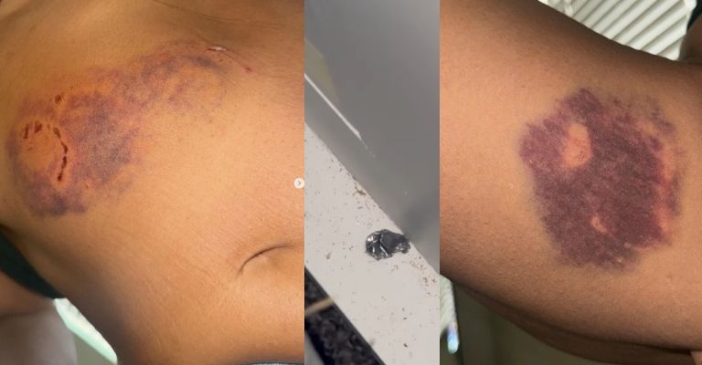 Eixchel Barroteran afirma que casi muere tras ataque a balazos de su padrastro