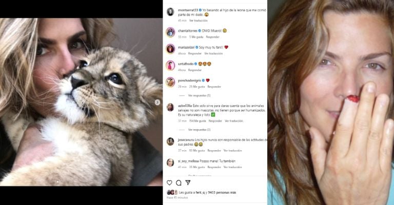 Montserrat Oliver comparte foto de su terrible tras mordida de una leona que se comió parte de su dedo