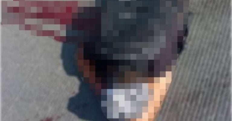 El occiso quedó tirado boca abajo y en medio de un charco de sangre