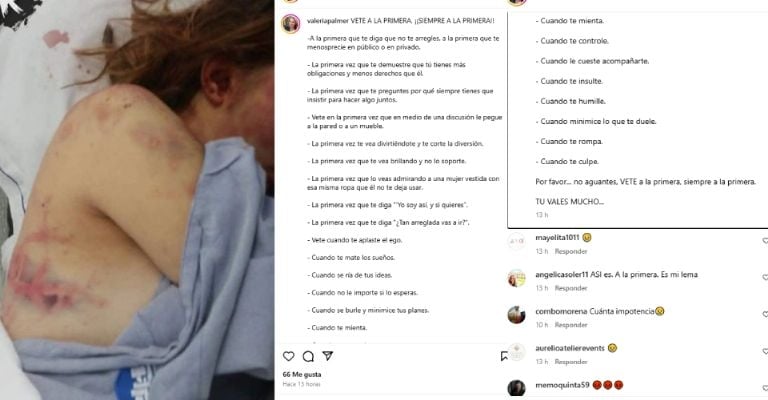 Valeria Palmer reaparece en redes con fotos desde el hospital golpeada y con mensaje del maltrato