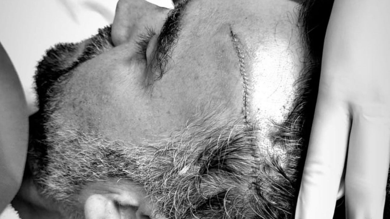 Enrique Acevedo regresa a En Punto tras accidente que casi termina en tragedia ¿Quién es?