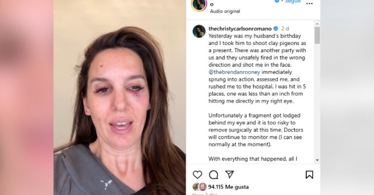 Christy Carlson Romano sobrevive a disparo en el ojo