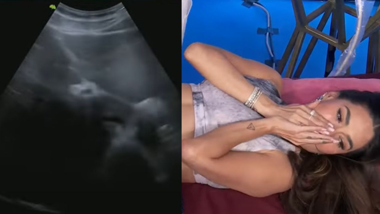 ¿Niño o niña? Galilea Montijo se hace ultrasonido en vivo en ‘Hoy’ tras rumor de embarazo