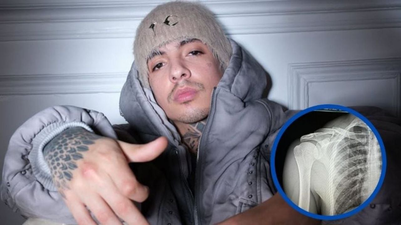 Terrible: Natanael Cano sufre fractura de clavícula tras accidente en motocross