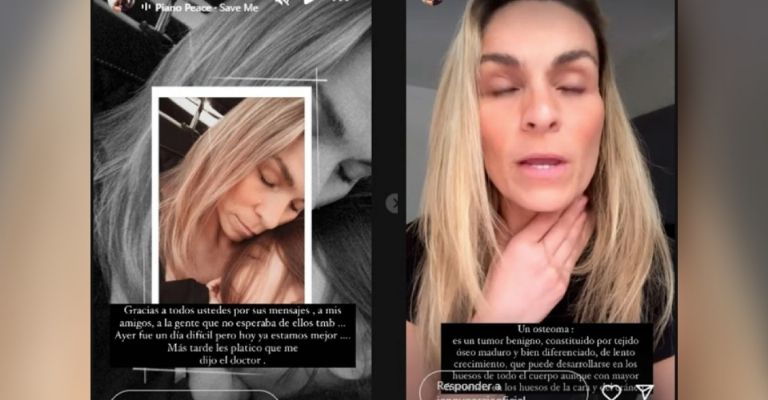 Jenny García da trágica noticia a Hoy y deja en shock a Televisa con su tumor craneal