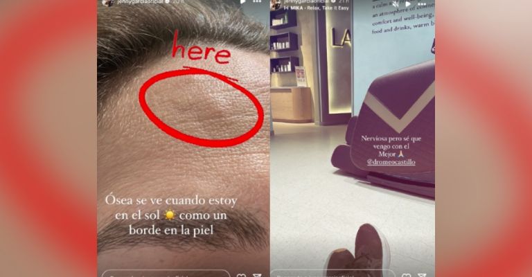 Jenny García da trágica noticia a Hoy y deja en shock a Televisa con su tumor craneal