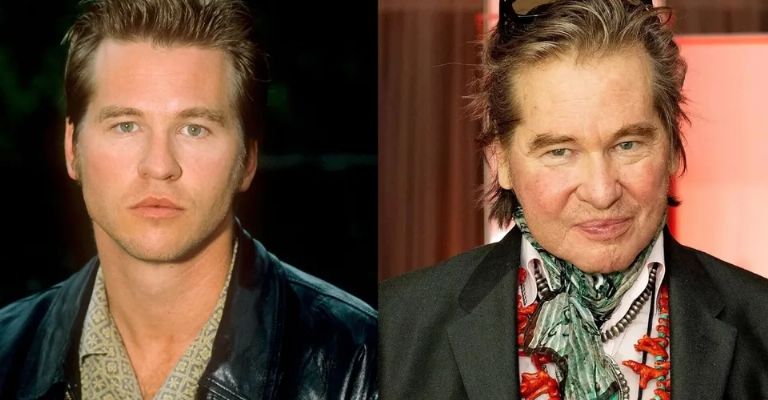 Val Kilmer murió; le ganó al cáncer pero perdió ante esta trágica enfermedad