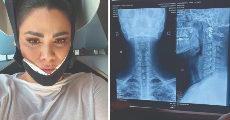Luz Elena González temió quedar paralítica tras fuerte accidente en Venga la Alegría