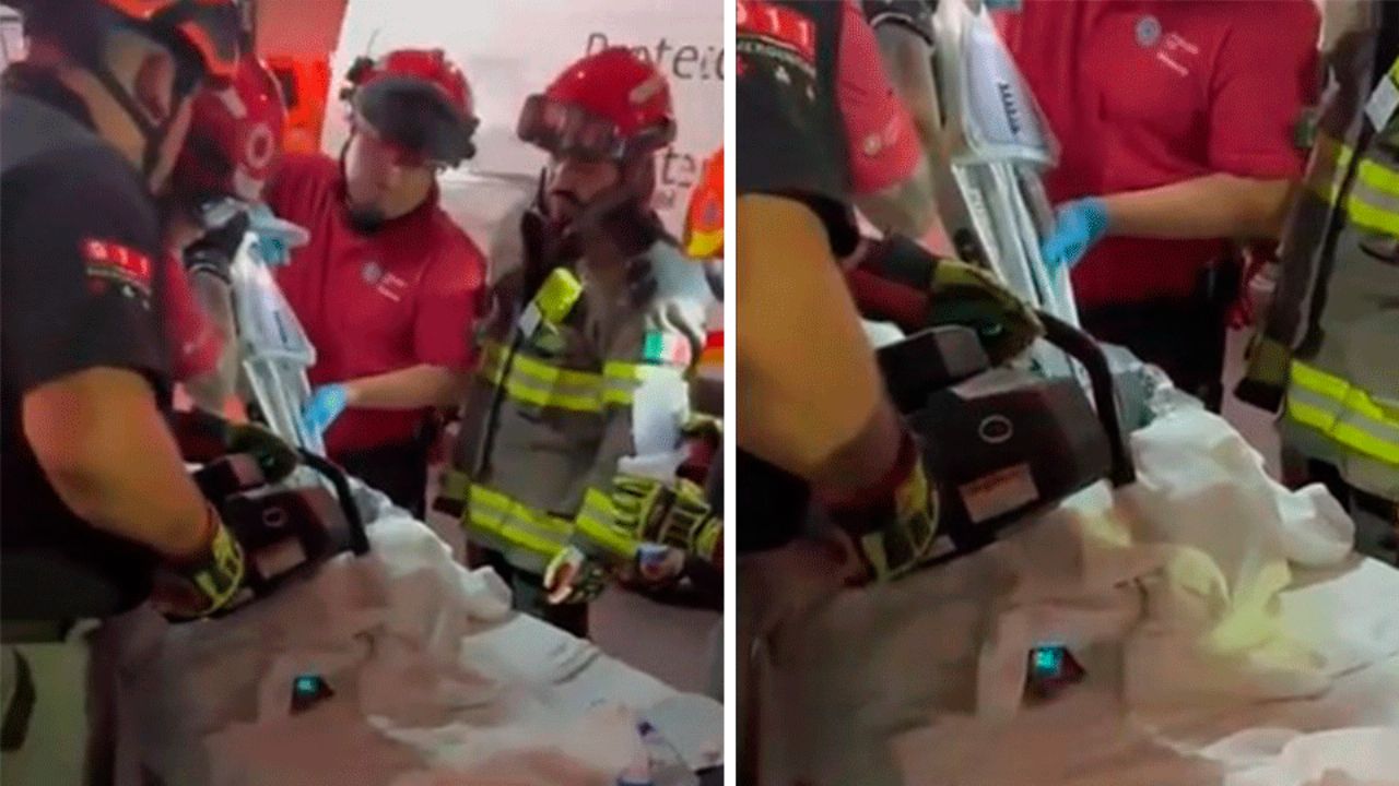 Menor de un año pierde una mano y antebrazo tras accidente con máquina en Nuevo León