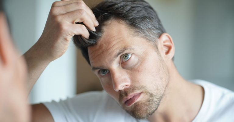 Encanecer a edad temprana suele a estar determinado por la genética