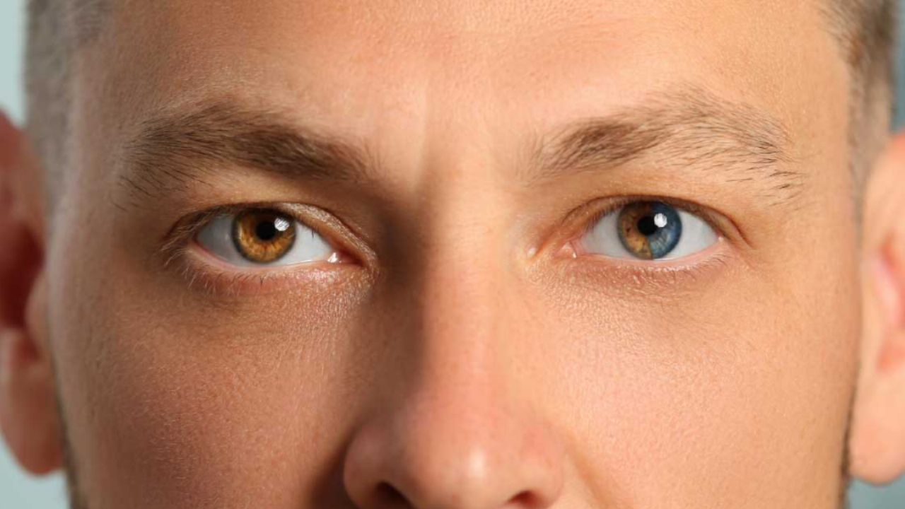 ¿Por qué algunas personas tienen los ojos de diferente color? Descubre la Heterocromía