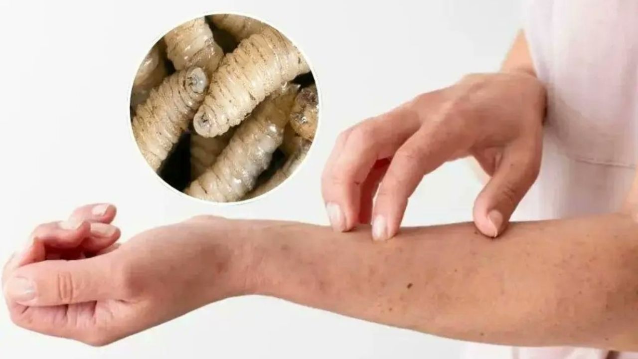 Reapertura de la frontera de EU al ganado: Confirman 30 casos de gusano barrenador en humanos