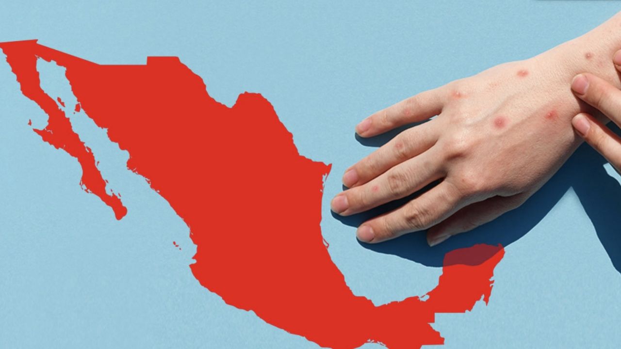 Alerta: México suma 12 muertes por sarampión; prevén eliminar casos este mismo año