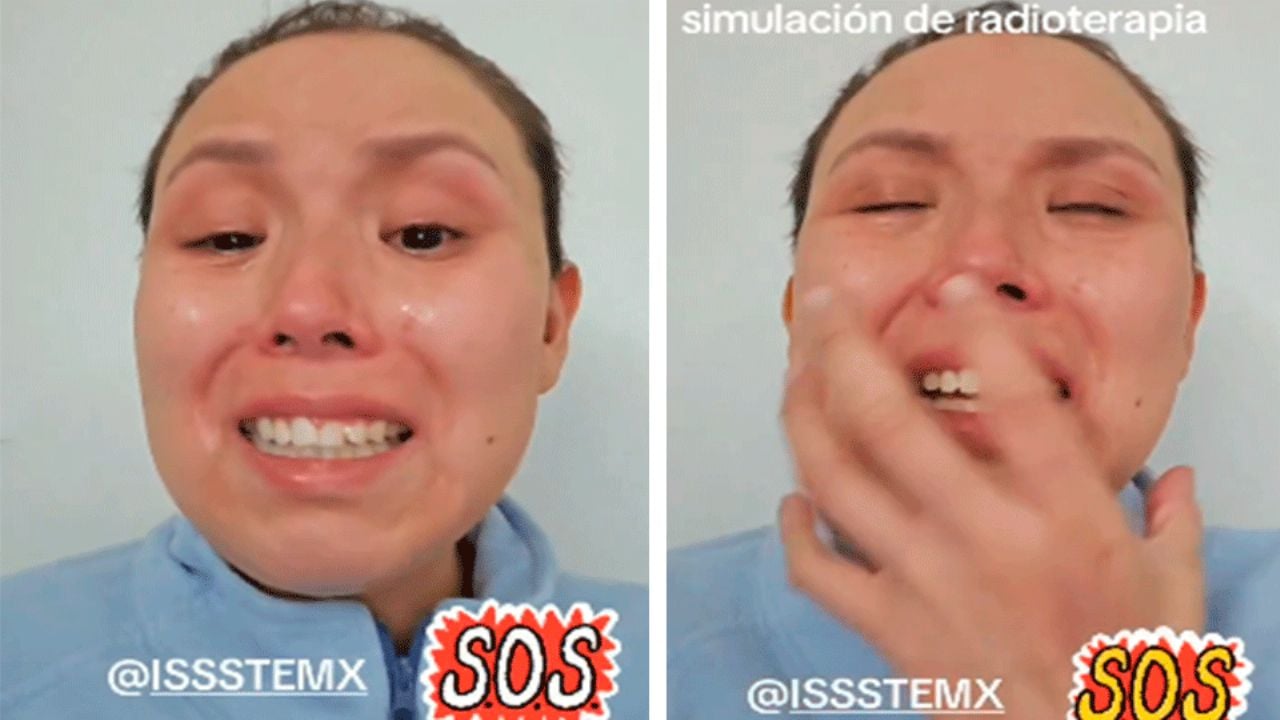 VIDEO: Paciente con cáncer en CDMX reclama al ISSSTE por máquina descompuesta