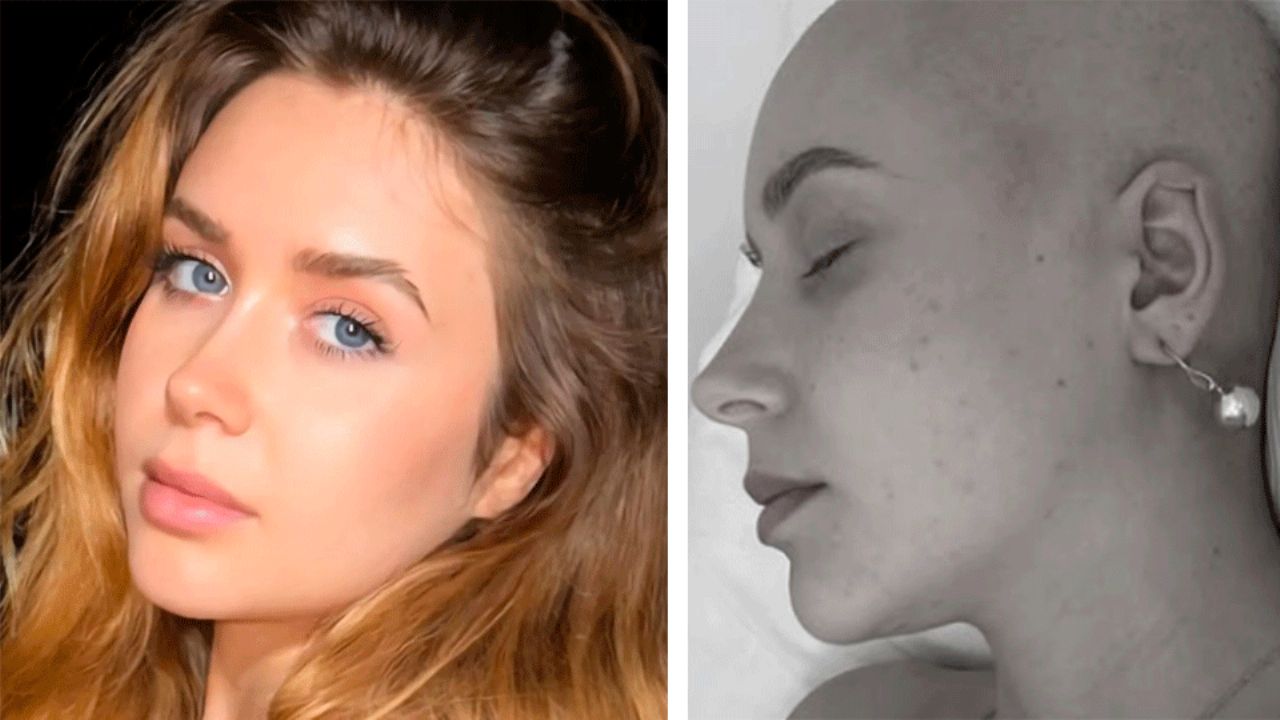 La imagen que conmueve: Exconcursante española de ‘Masterchef Junior’ enfrenta cáncer