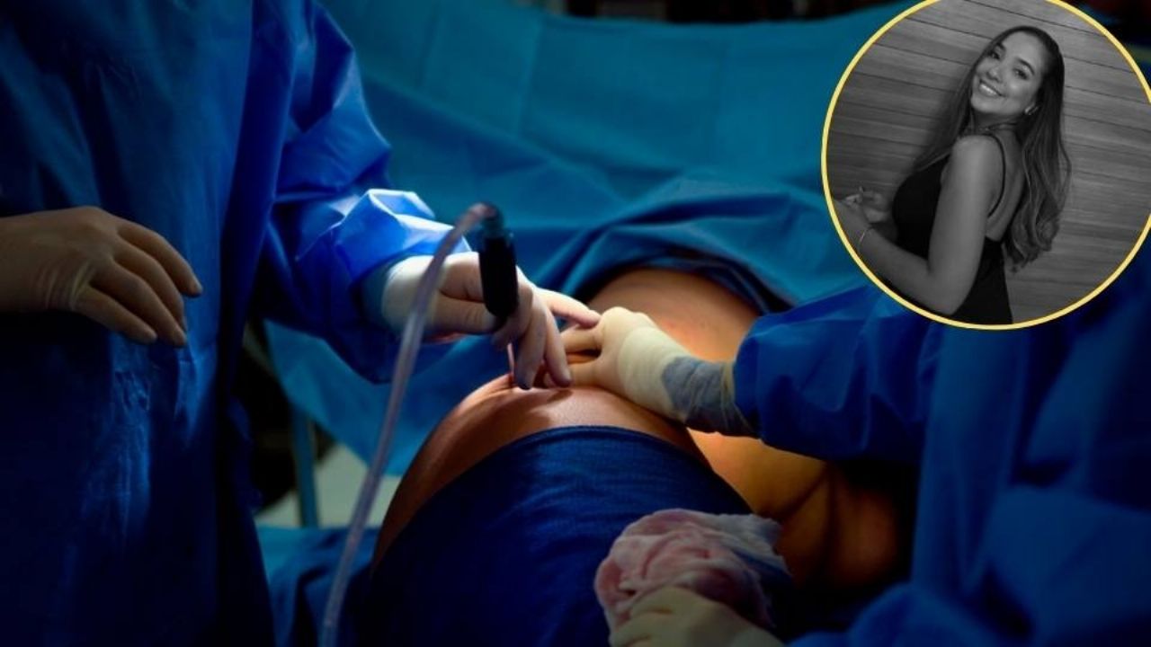 Conmoción en Brasil: Le regalan una liposucción por su cumpleaños y muere en la cirugía