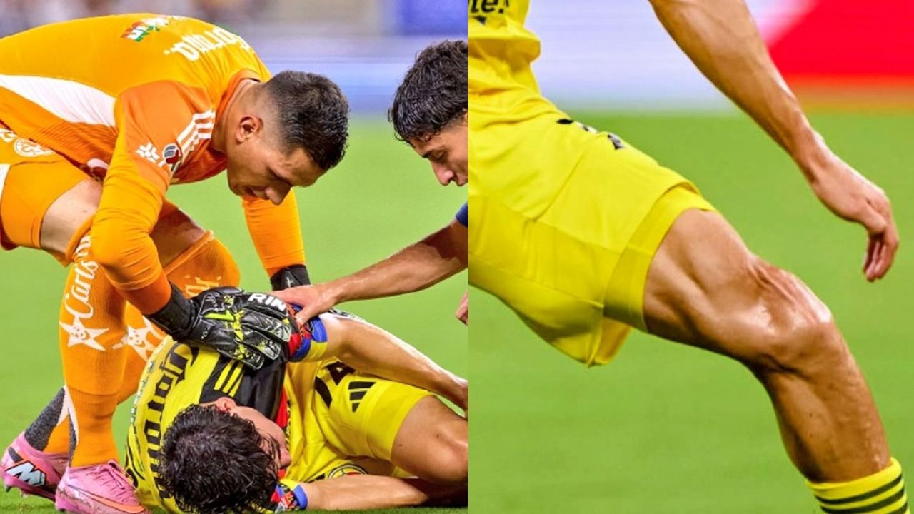 ¡Grave lesión! Jugador del América sufrió una rotura de ligamentos en partido contra Rayados