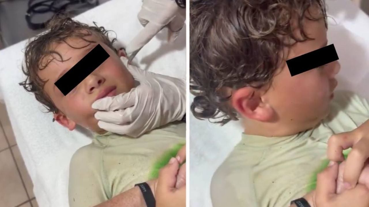 Influencer mexicana lleva a su hijo al doctor por un dolor en el oído; tenía un cangrejo