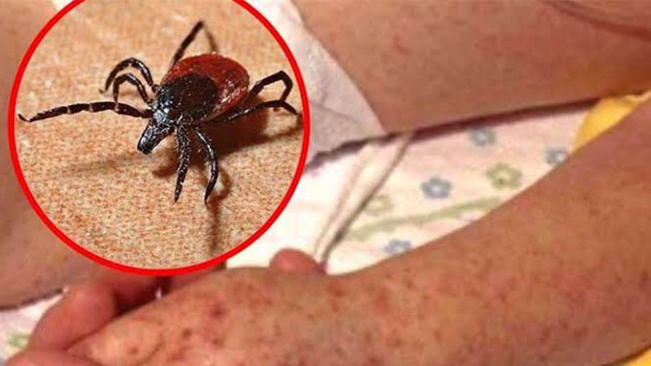 Navojoa: Región del Mayo suma 12 defunciones por rickettsia en 2025