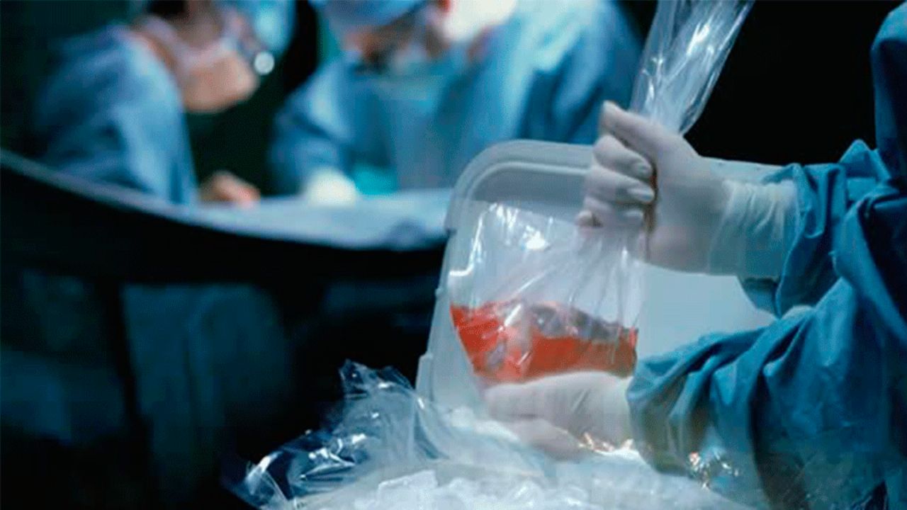 Sonora retrocede en donación de órganos y preocupa a pacientes que esperan trasplante