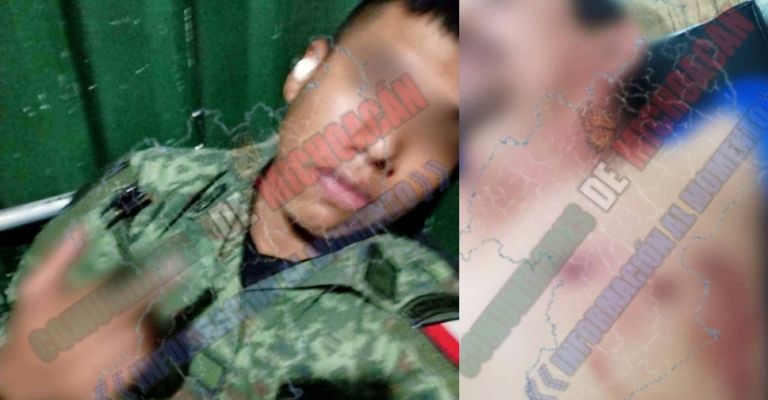 Serían los elementos atacados