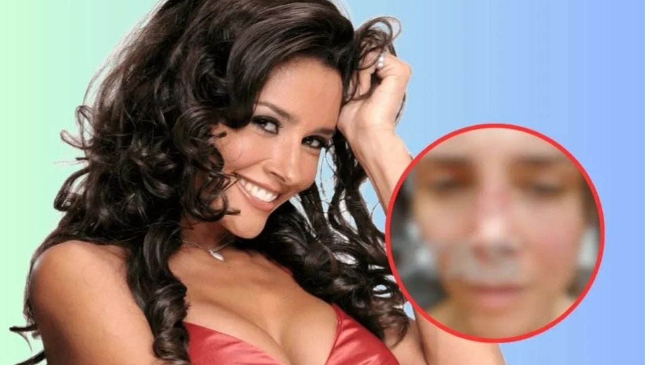 Famosa actriz de Televisa acaba desfigurada tras mala cirugía estética; filtran impactantes FOTOS