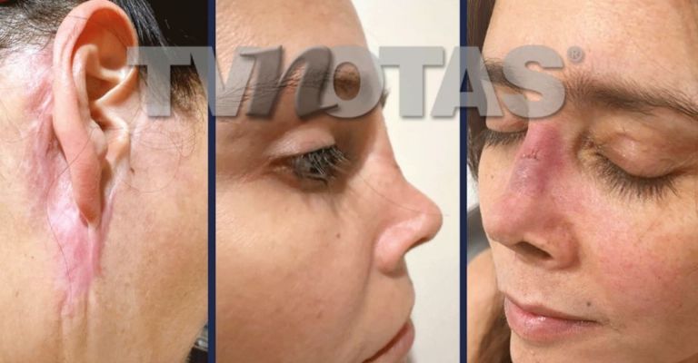 Dorismar acaba desfigurada tras mala cirugía estética