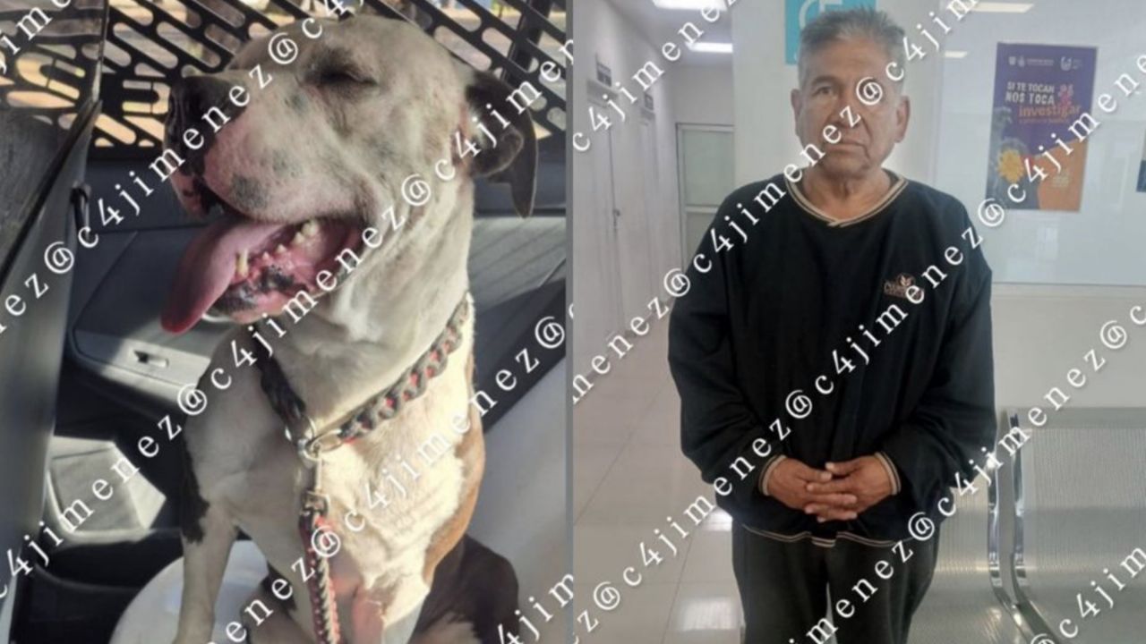 Perro pitbull se suelta y se lanza contra un hombre; así ocurrió el BRUTAL ATAQUE en GAM, CDMX