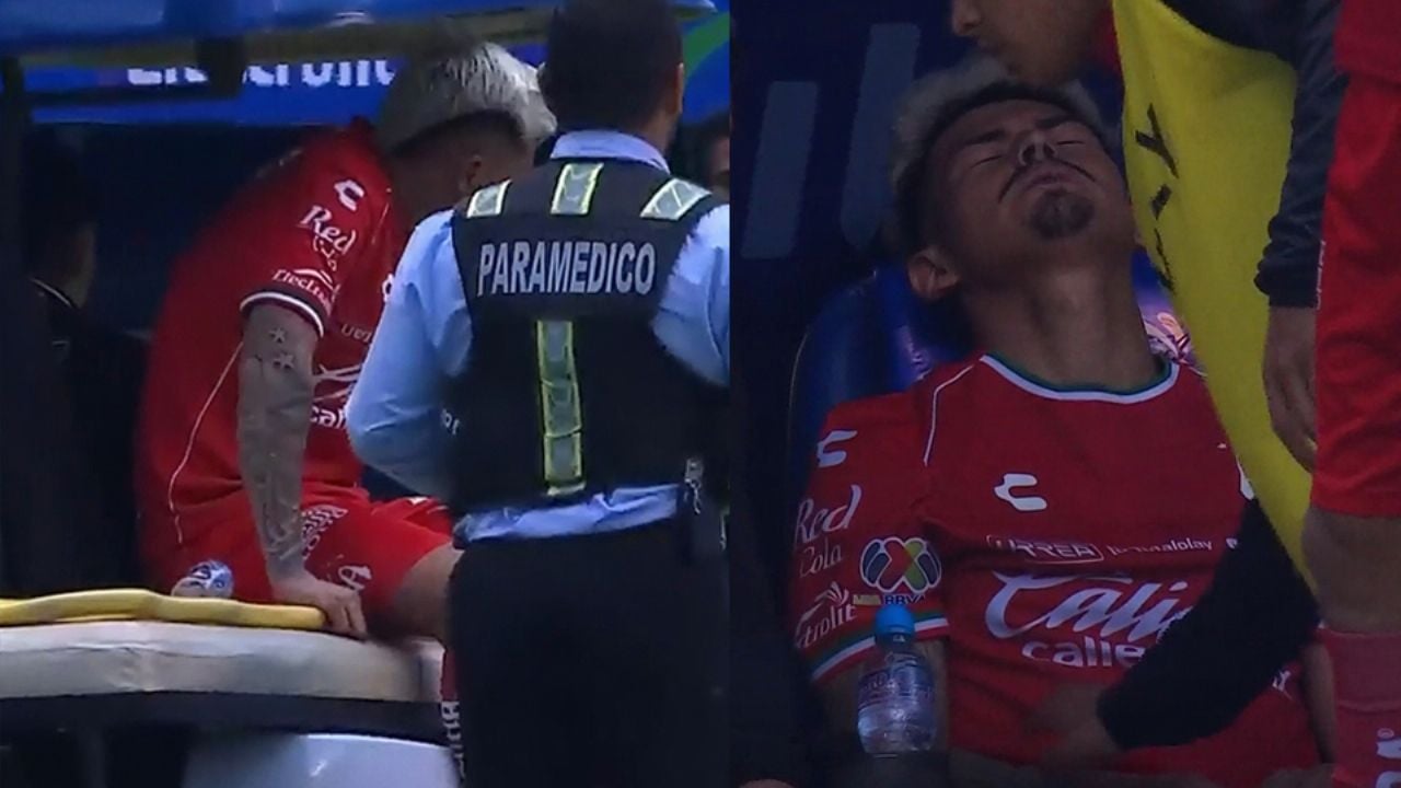 Futbolista del Atlas sufre escalofriante lesión ante el Cruz Azul; salió entre lágrimas y en camilla