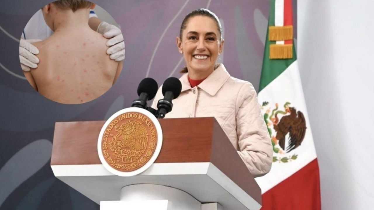 Sarampión en México: Sheinbaum confirma brotes en Jalisco, CDMX y Edomex; hay vacunas, dice