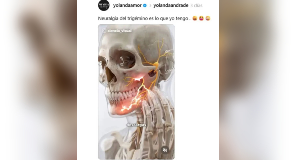 Yolanda Andrade revela su nueva enfermedad