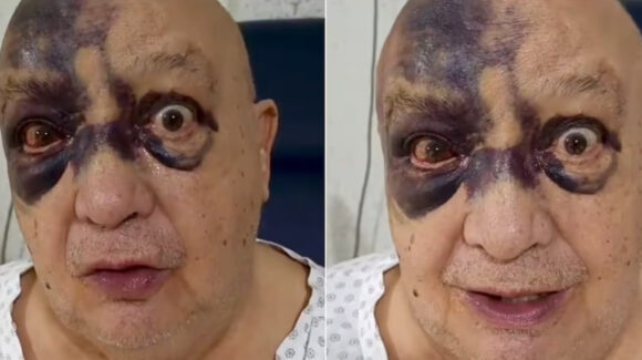 “Fue doloroso”: Esposa de Luis de Alba aparece tras accidente del actor de Televisa y revela si está grave
