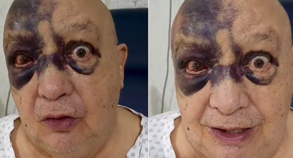 Esposa de Luis de Alba aclara cómo fue accidente del actor de Televisa