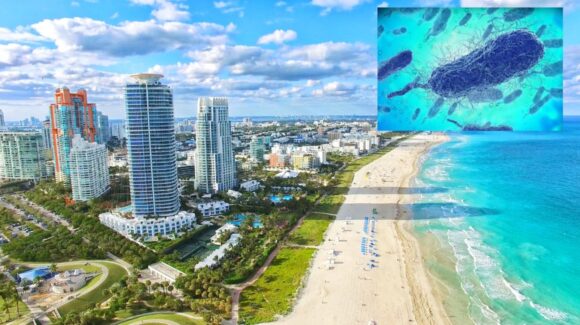 Florida confirma cinco casos de infección por bacteria carnívora
