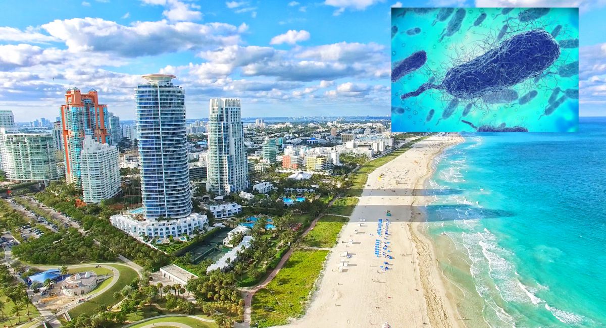 Florida confirma cinco casos de infección por bacteria carnívora