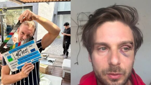 Actor de Televisa, Joan Kuri, resulta herido en altercado vial en Estado de México