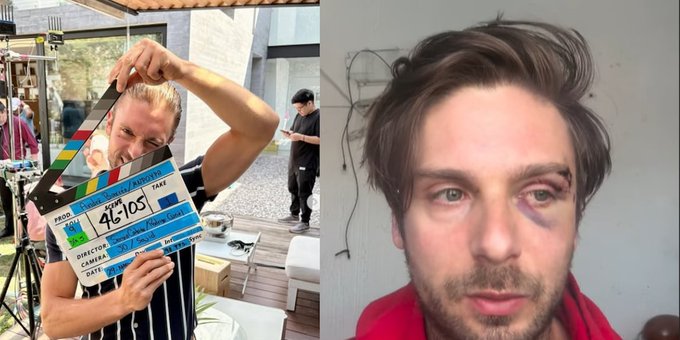 Actor de Televisa, Joan Kuri, resulta herido en altercado vial en Estado de México.
