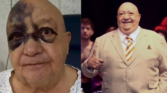 “Me quedé tirado 10 horas”: Luis de Alba narra detalles de su terrible accidente en caso; ¿está grave?