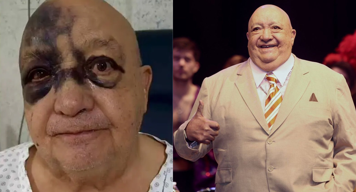 Luis de Alba habla de su accidente y revela si está grave de salud