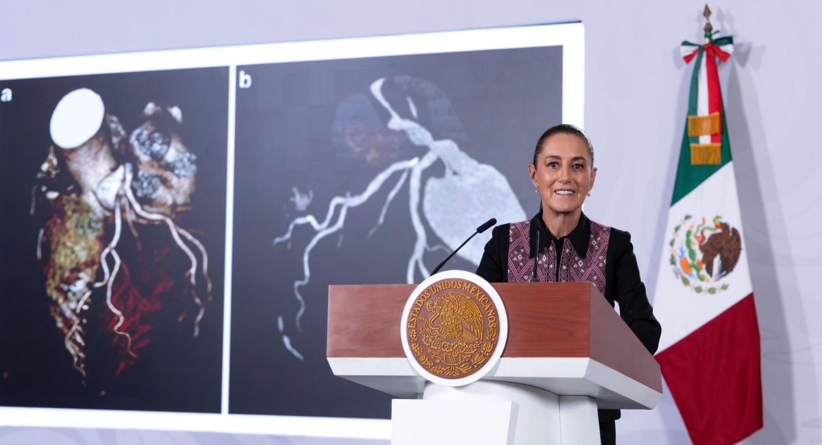 Sheinbaum destaca nuevos tomógrafos del IMSS y expansión de telemedicina