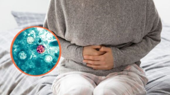 Brote de ciclosporiasis: ¿Qué tan probable es que llegue a México?