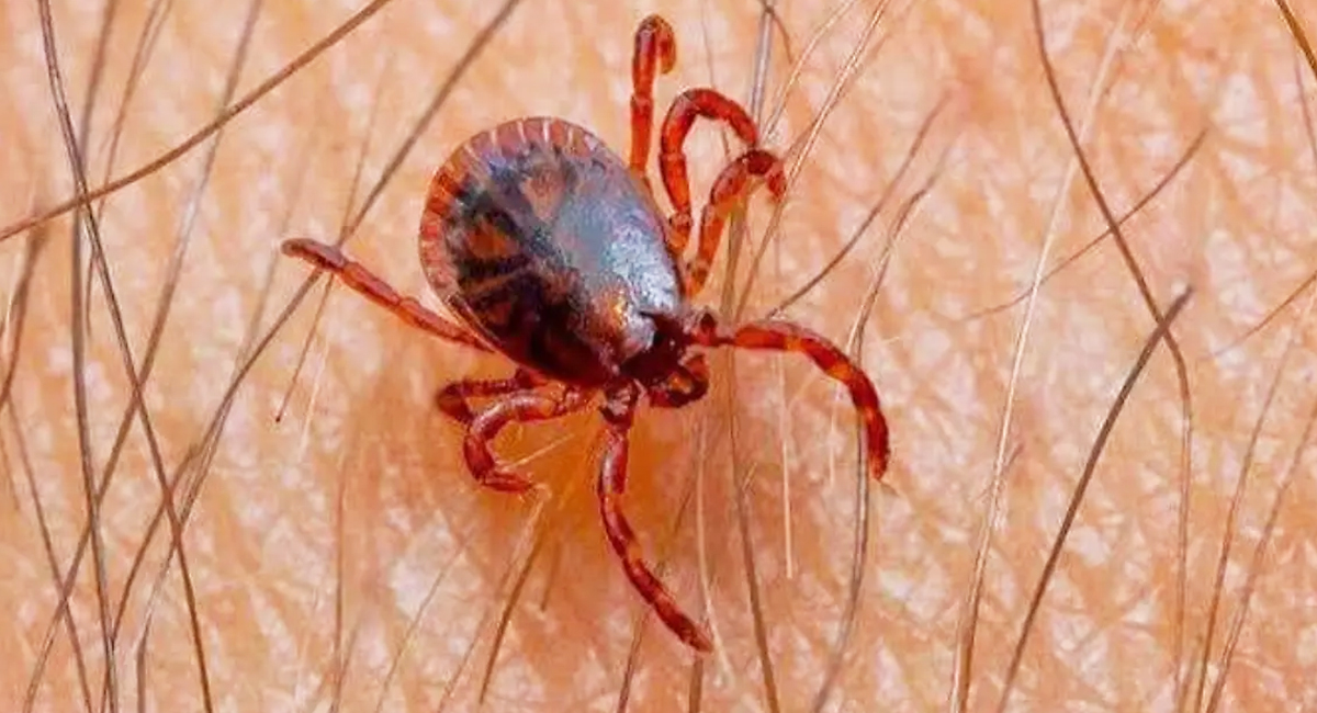 Cajeme registra 100% de letalidad por rickettsiosis; siete casos terminaron en muerte