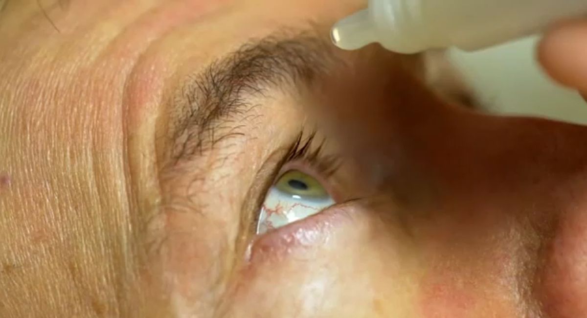 Alerta en Estados Unidos: ordenan el retiro masivo de gotas para los ojos por riesgo de contaminación