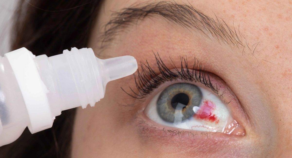 Alerta en Estados Unidos: ordenan el retiro masivo de gotas para los ojos por riesgo de contaminación