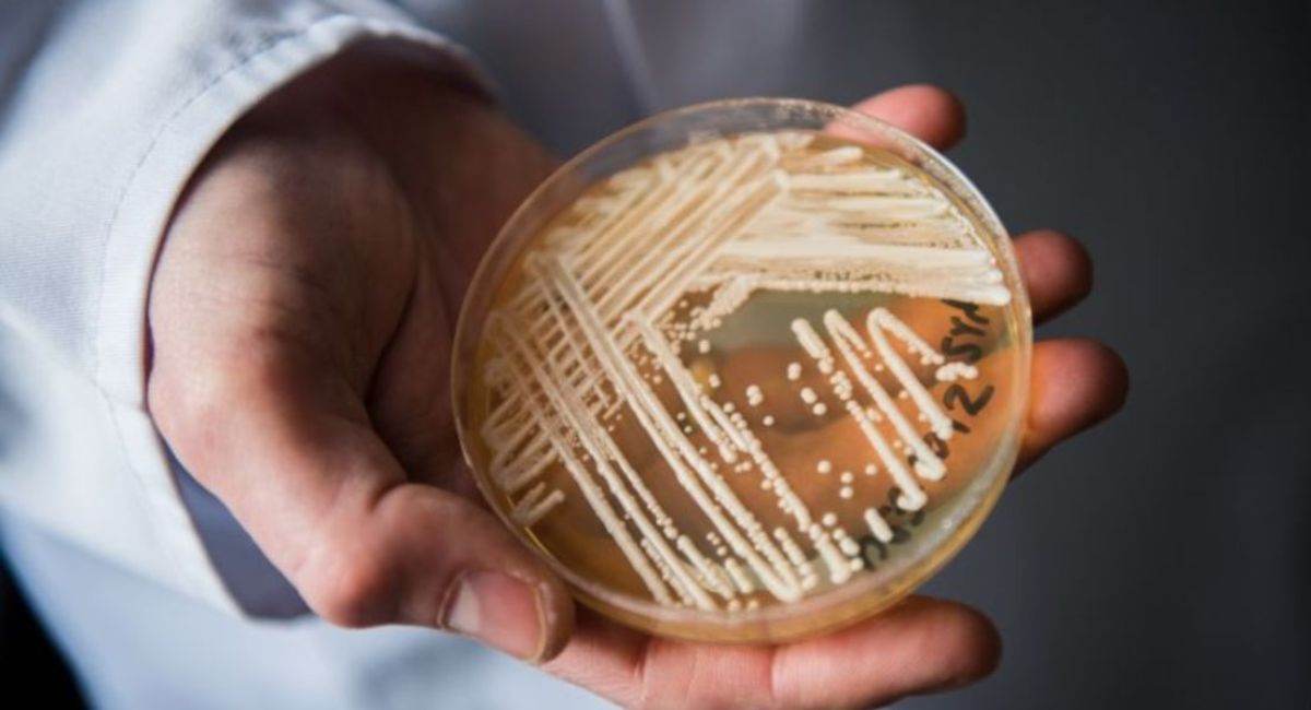 CDC confirma más de 3 mil casos de un brote de Candida auris en Estados Unidos resistente a medicamentos