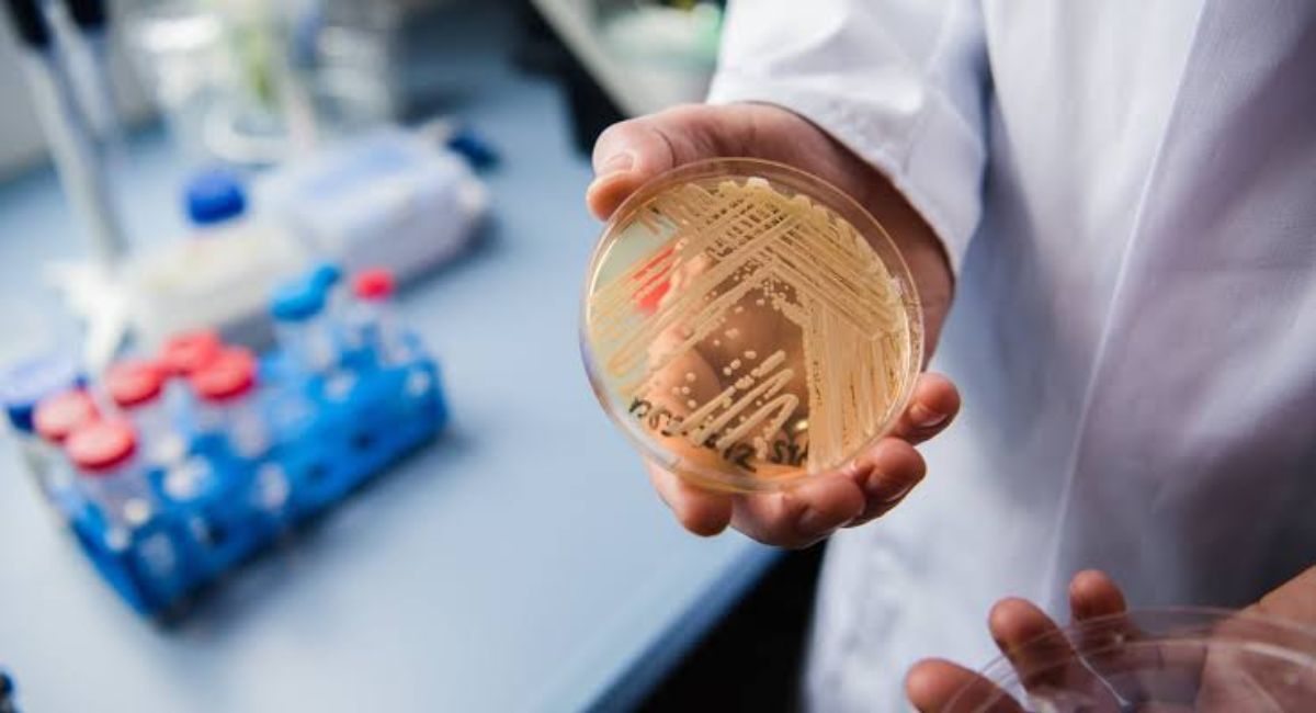 CDC confirma más de 3 mil casos de un brote de Candida auris en Estados Unidos resistente a medicamentos