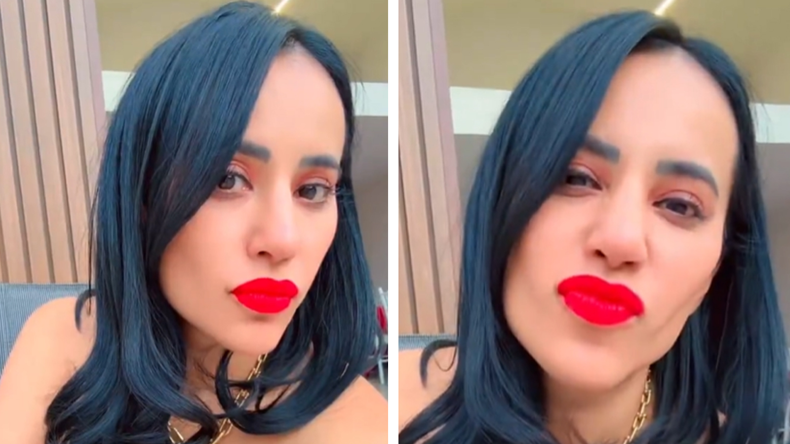 VIDEO: Desde el hospital, Sandra Cuevas reaparece tras cirugía plástica y luce irreconocible