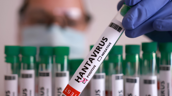 Turista da positivo a hantavirus tras viaje en Francia; se encuentra aislado en Galicia